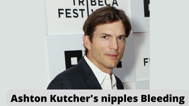 Ashton Kutcher's nipples Bleeding