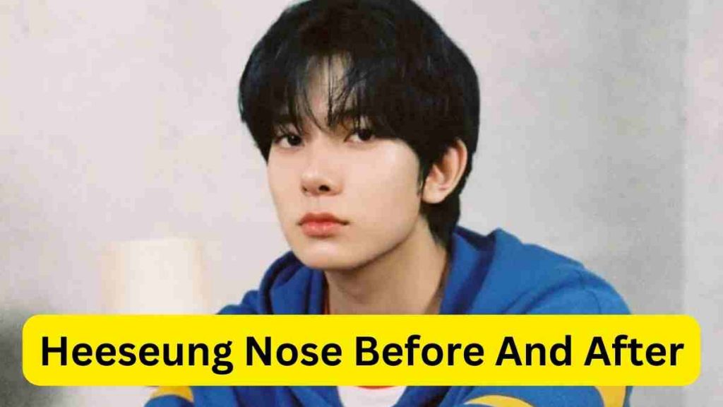 Heeseung Nose Before And After Transformations