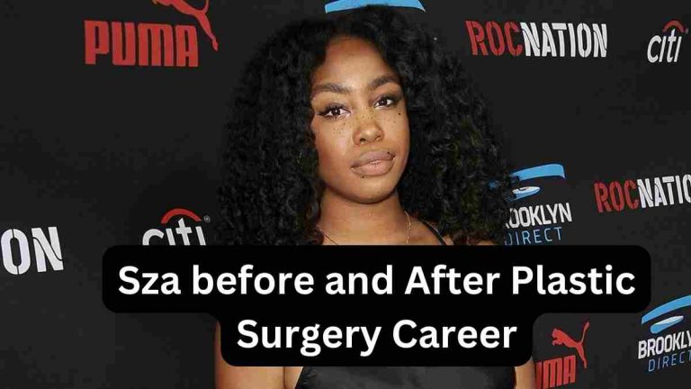 Sza before and After Plastic Surgery Career