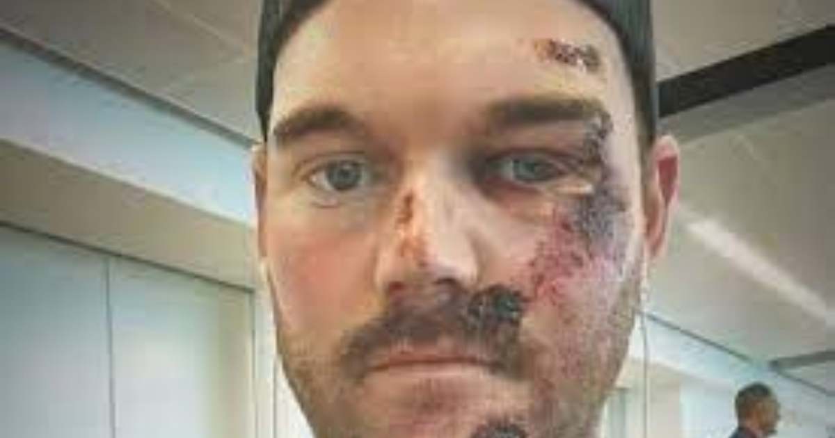 Grayson Murray Career